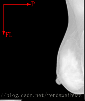 DR和乳腺(MG)的挂片方位描述