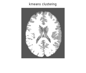 kmeans算法分割图像