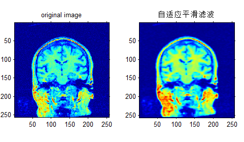 自适应平滑滤波