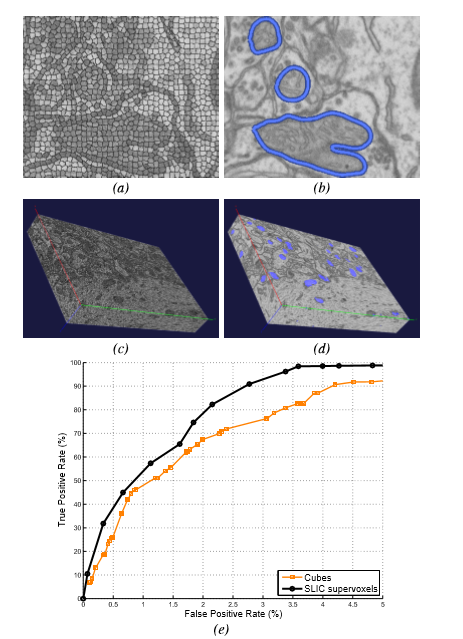 SLIC与目前最优超像素算法的比较  SLIC Superpixels Compared to State-of-the-art Superpixel Methods