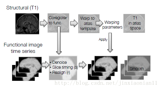 图 1 fMRI数据预处理流程