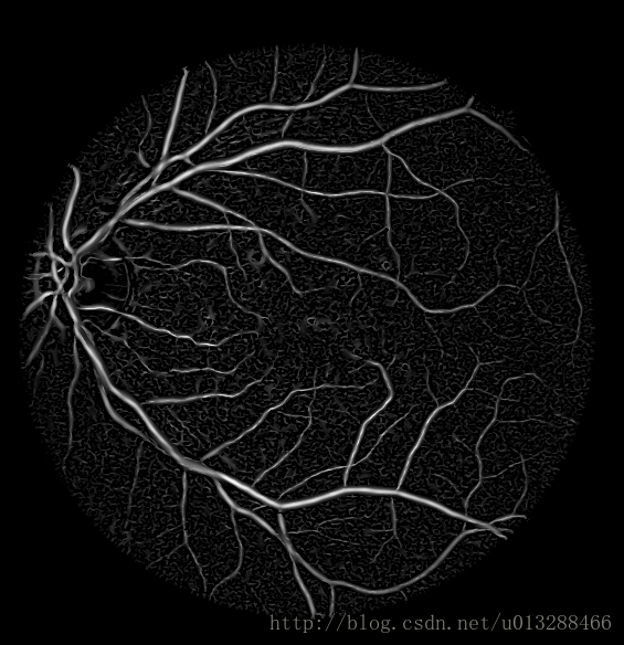 眼底视网膜血管增强方法（五）Hessian矩阵最大特征值