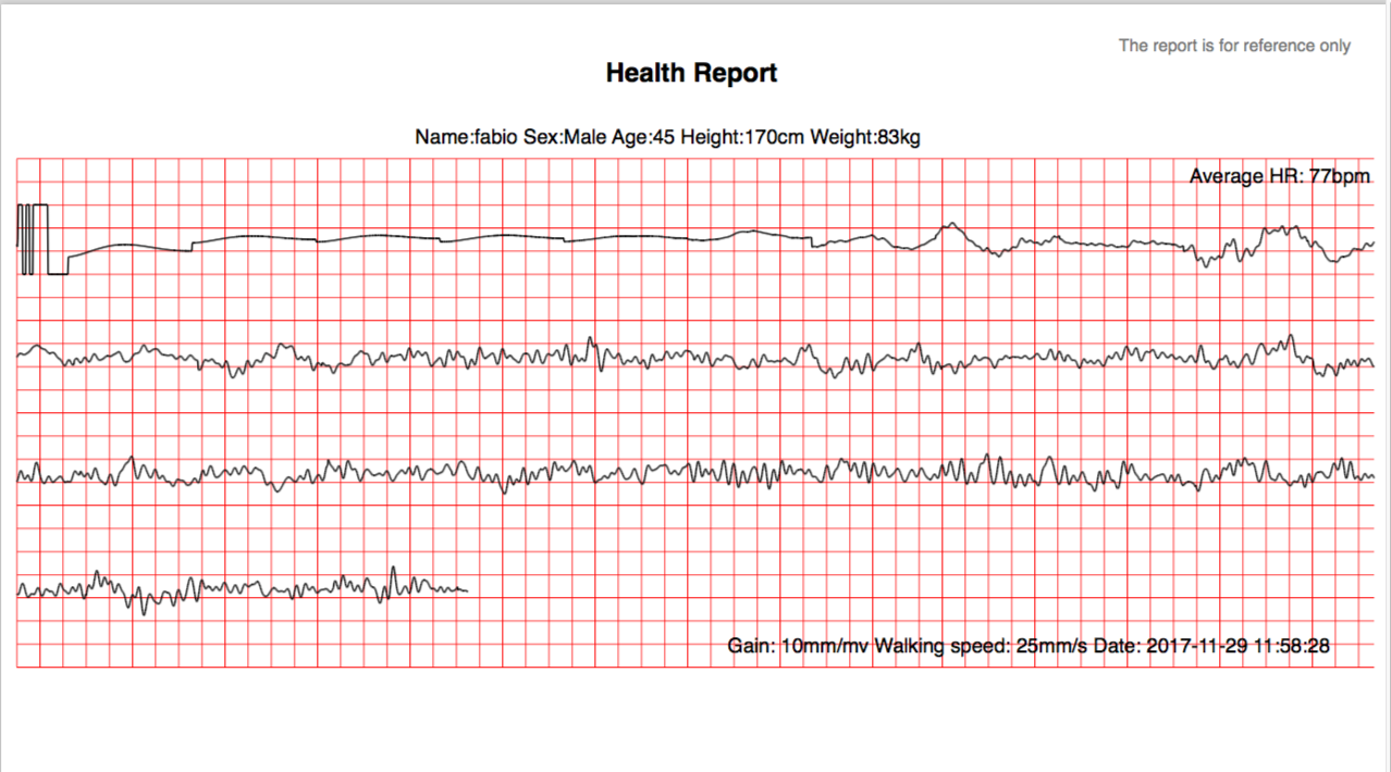 [Reprinted] VERDI method FSDBREPORT draws a signal value of FSDB to ...