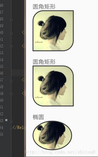 圆角图片_RoundedImageView