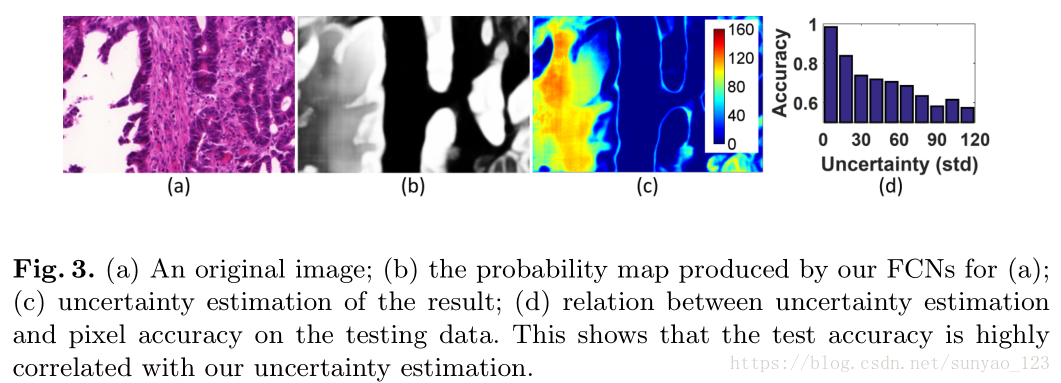 Suggestive Annotation: A Deep Active Learning Framework for Biomedical Image Segmentation-笔记