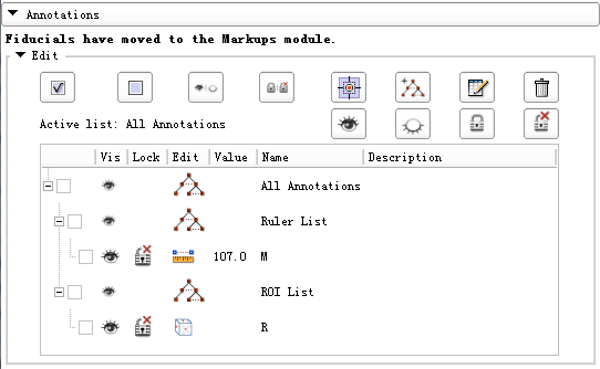 3Dslicer_AnnotationsModule第1张