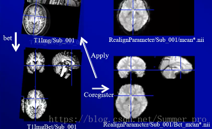 Resting State fMRI Data Processing