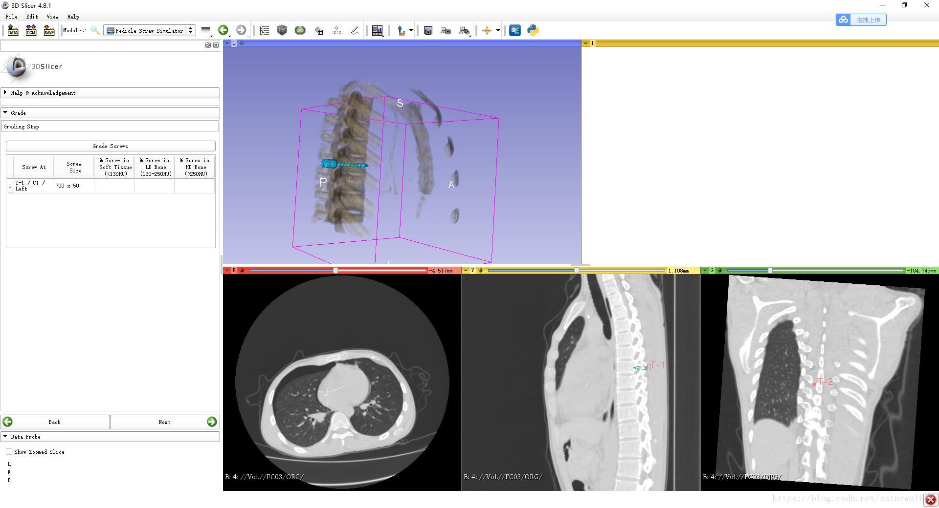 介绍3D Slicer的另一个身份：医学影像IDE